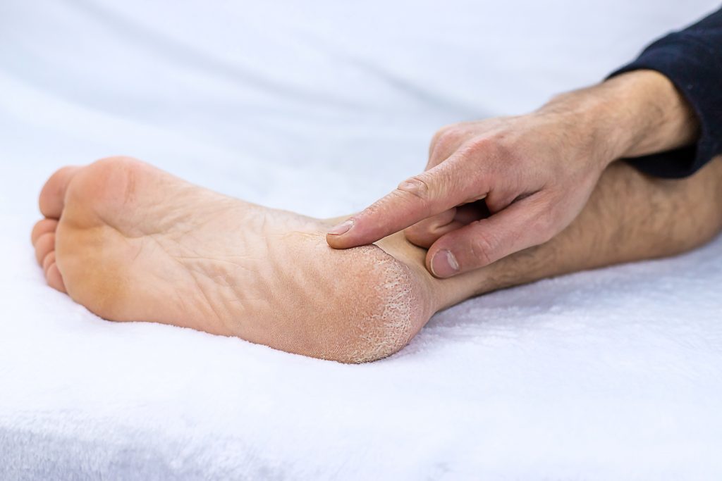 suche-piety-podatne-na-modzele